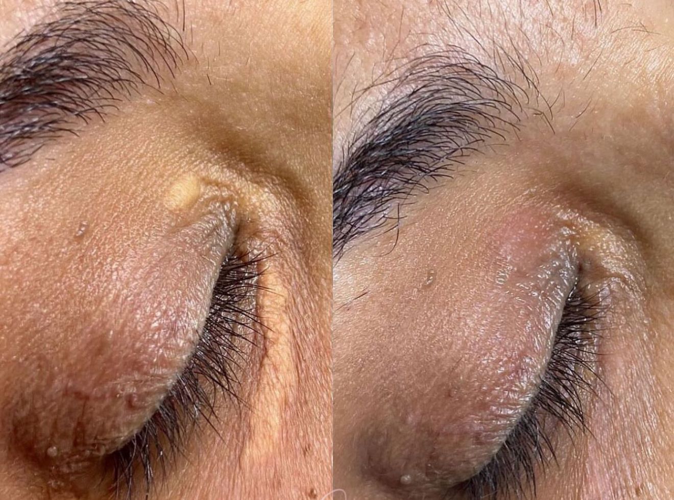 Metabolic Transformation